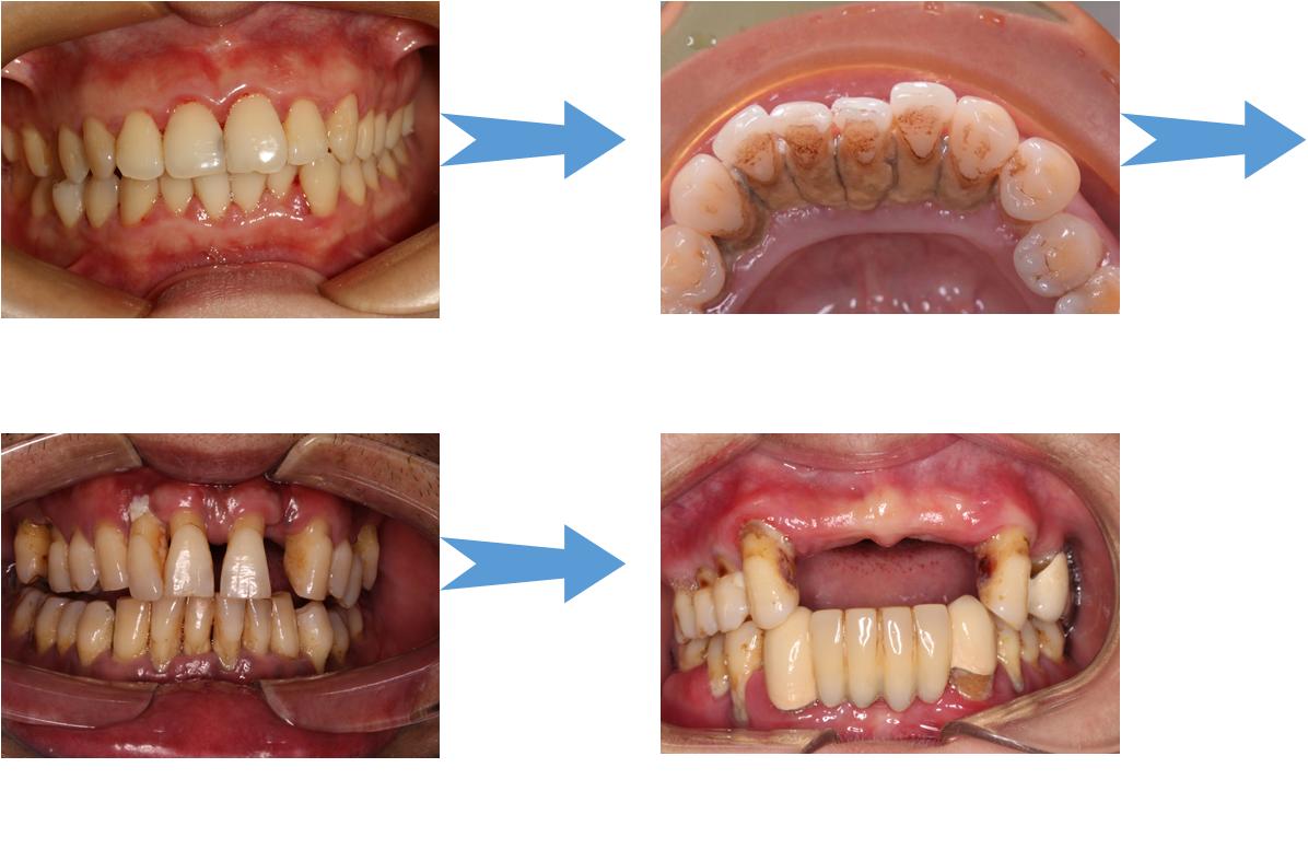 �����˵Ŀ�ǻ����