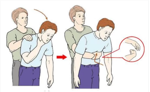 这些意外,如何急救