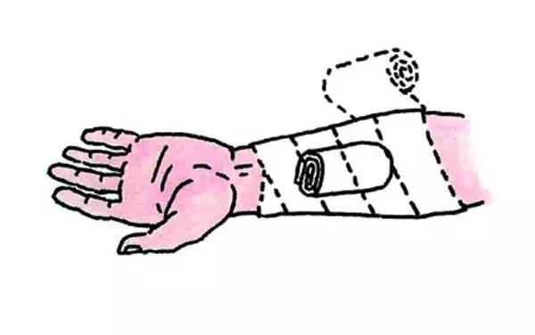 这些意外,如何急救