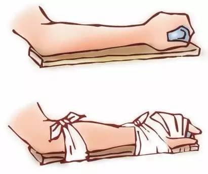 这些意外,如何急救